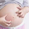 La colestasi gravidica ✿