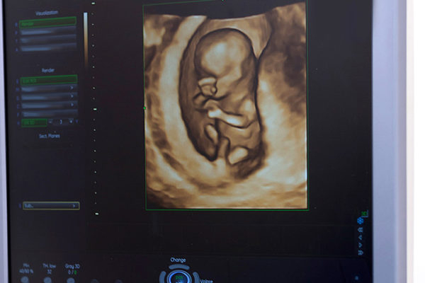 Trapianto di utero vs. Maternità surrogata